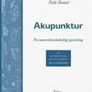 Akupunktur