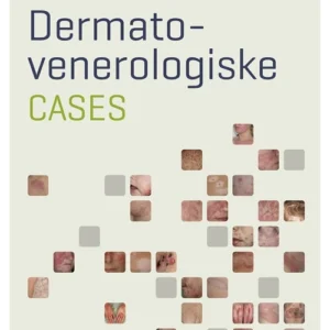 Dermato- venerologiske cases