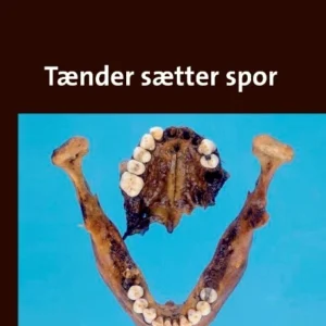 Tænder sætter spor