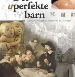 Det uperfekte barn
