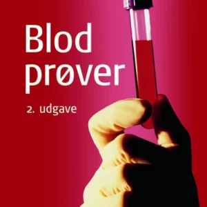Blodprøver