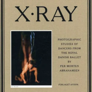 X-RAY