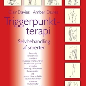 Triggerpunkt-terapi