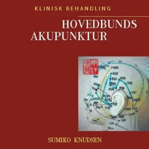 Hovedbundsakupunktur