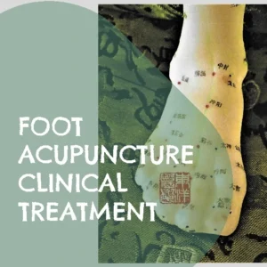 Foot Acupuncture Clinical Treatment