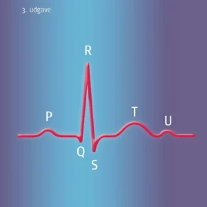 EKG