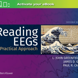 Reading Eegs A Practical Approach