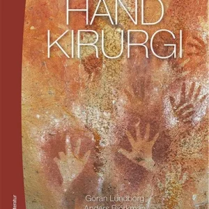 Handkirurgi