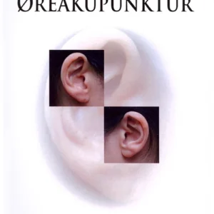 Kinesisk øreakupunktur