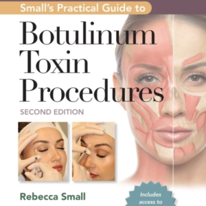 Small'S Practical Guide To Botulinum Toxin Procedures Print