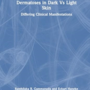 Dermatoses In Dark Vs Light Skin Differing Clinical Manifest