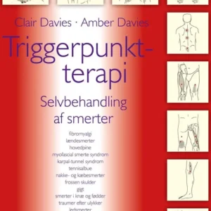 Triggerpunkt-terapi